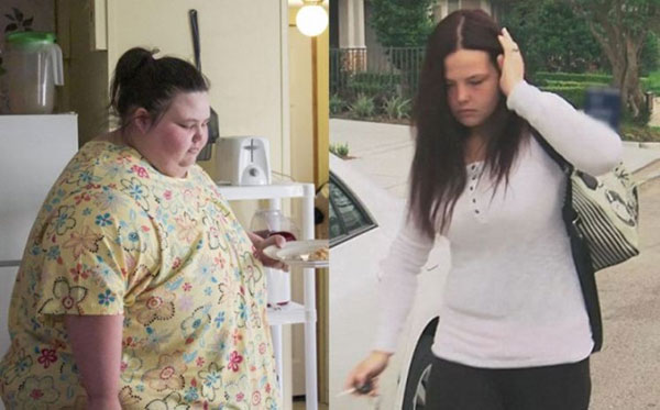 Cuộc sống khó tin của cô gái nặng 312 kg cắt bỏ mỡ thừa - 1