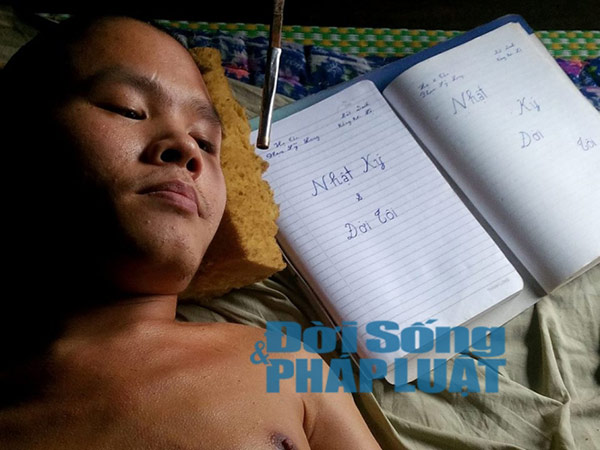 Khâm phục chàng trai bị bại liệt vẽ tranh bằng miệng - 1