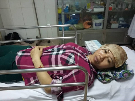 Nghệ An: Nổ lớn ở khu công nghiệp, nhiều người bị thương - 5