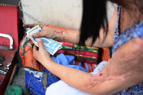 Nỗi đau người mẹ bị tạt axit: Bỏ việc vì sợ con tự tử - 2