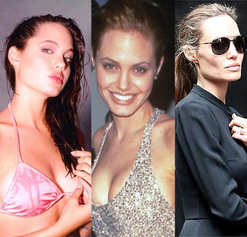 Loạt ảnh Angelina Jolie gầy trơ xương vì bệnh biếng ăn - 2