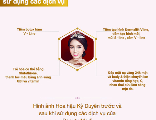 Hoa hậu Kỳ Duyên bị nghi ngờ nói dối chuyện thẩm mỹ - 3