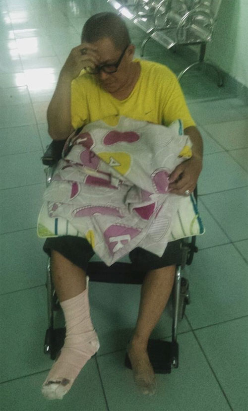 Nghệ sỹ hài Thanh Long Trẻ tai nạn đứt bàn chân phải - 1
