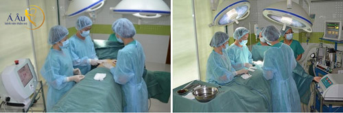 Những điều cần biết trước khi quyết định hút mỡ - 4