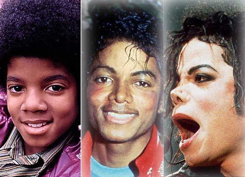 The impressive 25 years of "plastic surgery" of pop king Michael Jackson - 1