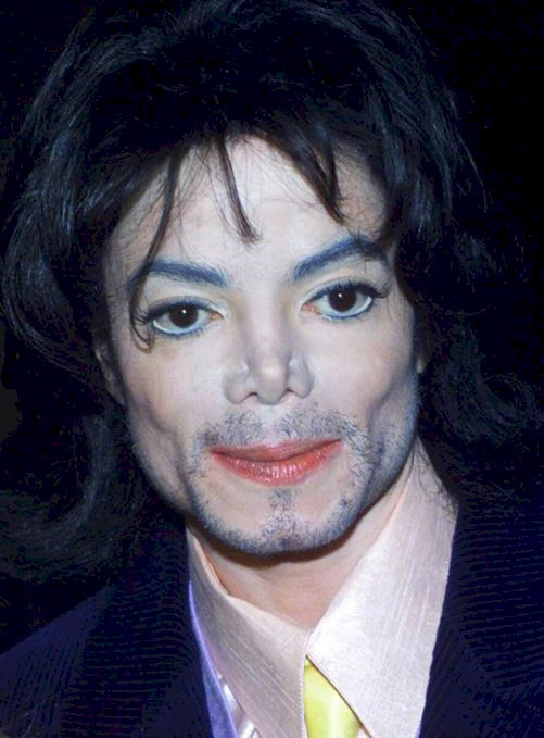 The impressive 25 years of "plastic surgery" of pop king Michael Jackson - 9