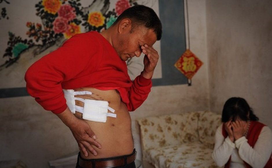 TQ: Mất thận sau phẫu thuật, tìm thấy ngay trong bụng - 1