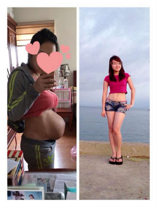 Hình ảnh mang thai của cô gái khiến "nửa thế giới" rơi nước mắt - 3