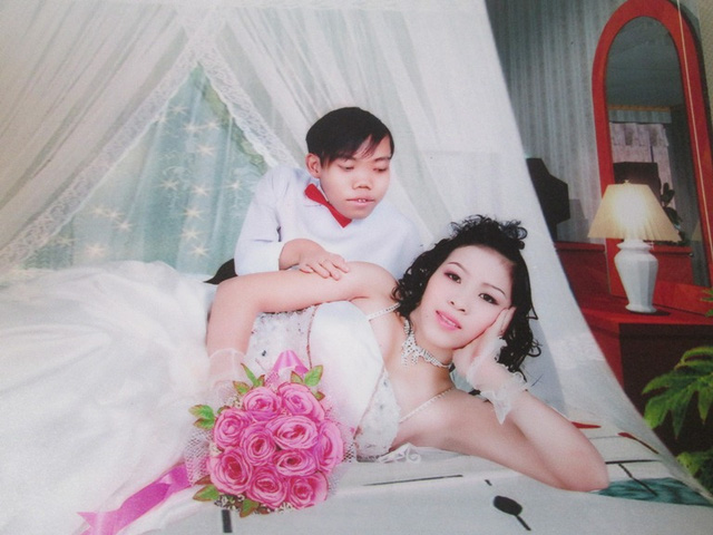 Chuyen tinh cua chang lun va chan dai