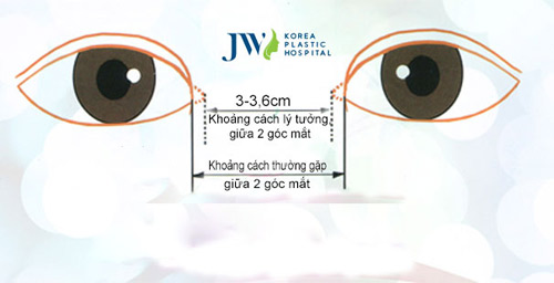 Phẫu thuật mắt to - Xóa tan nỗi lo thẩm mỹ mắt hỏng - 5