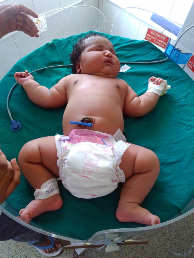 Bé gái sơ sinh 6,8kg nặng nhất thế giới chào đời - 1