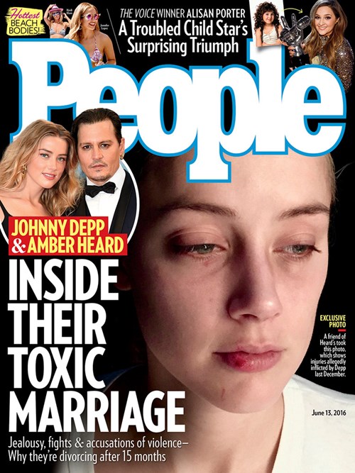 Vợ cũ Johnny Depp kể chi tiết 2 vụ bị chồng hành hung - 1