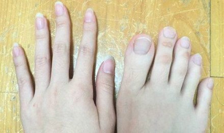 Nữ sinh nổi tiếng vì "ngón chân dài như ngón tay" - 1