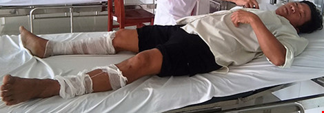 Tạm giữ nghi can tưới dầu đốt công an viên - 3