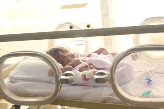 Bệnh viện ở Gia Lai cứu bé sơ sinh Campuchia nặng 700 g - 1