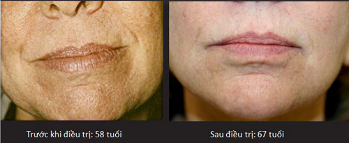 Đảo ngược thời gian lấy lại nhan sắc thanh xuân, tại sao không? - 2