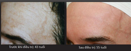 Đảo ngược thời gian lấy lại nhan sắc thanh xuân, tại sao không? - 3