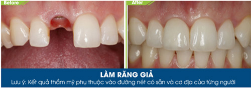 Thành lập trung tâm chuyên niềng răng tại JW Hàn Quốc - 5