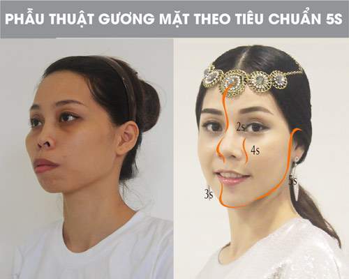 'Phép màu sắc đẹp': Mẹ một con hàm hô hóa ‘công chúa’ - 3