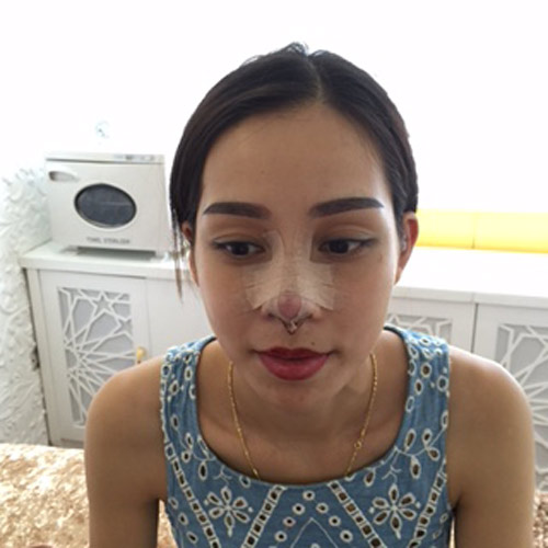 'Phép màu sắc đẹp': Mẹ một con hàm hô hóa ‘công chúa’ - 4