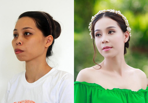 'Phép màu sắc đẹp': Mẹ một con hàm hô hóa ‘công chúa’ - 6