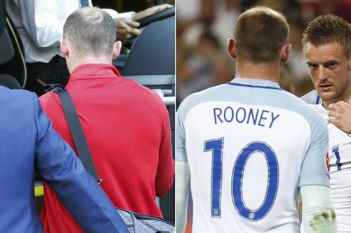 Thua Iceland, chỉ 1 đêm Rooney "xuống cấp" trầm trọng - 1