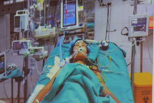 100 y bác sĩ “cân não” ghép gan cứu sống bệnh nhân xin về chờ chết - 1