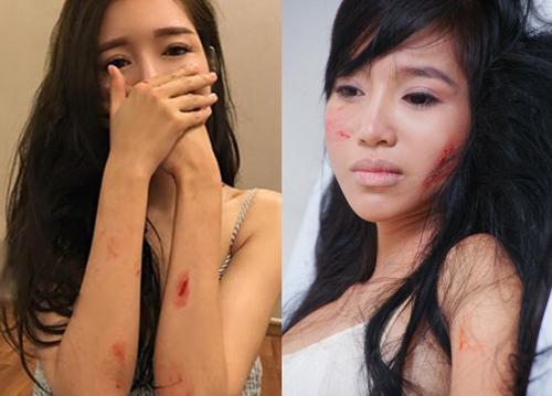 Mỹ nhân bầm dập vì đóng phim: Elly Trần chưa chắc "lỳ đòn" nhất! - 8