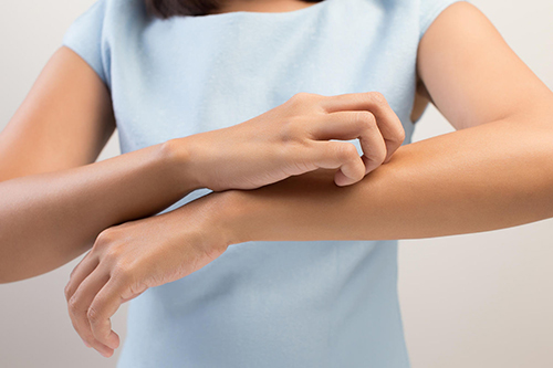 Cảnh báo: Ngứa dữ dội có thể là biểu hiện của suy thận - 1