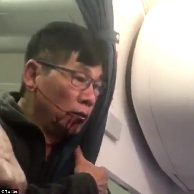 Bác sĩ gốc Việt bị kéo lê khỏi máy bay Mỹ: Dư luận phẫn nộ - 1