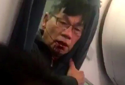 Ông David Dao có thể thắng kiện United Airlines? - 3