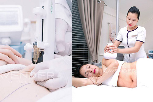 Đừng để đùi ếch, tay to làm mất nét duyên của bạn - 4