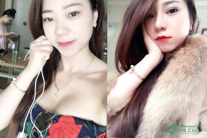 “Bà nội trợ” hóa cô nàng sang chảnh nhờ combo tiểu phẫu - 1