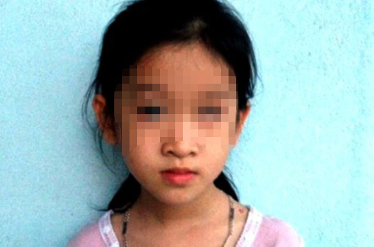 Bé gái bị mù mắt, gia đình đòi nhà trường bồi thường 1 tỉ đồng - 1