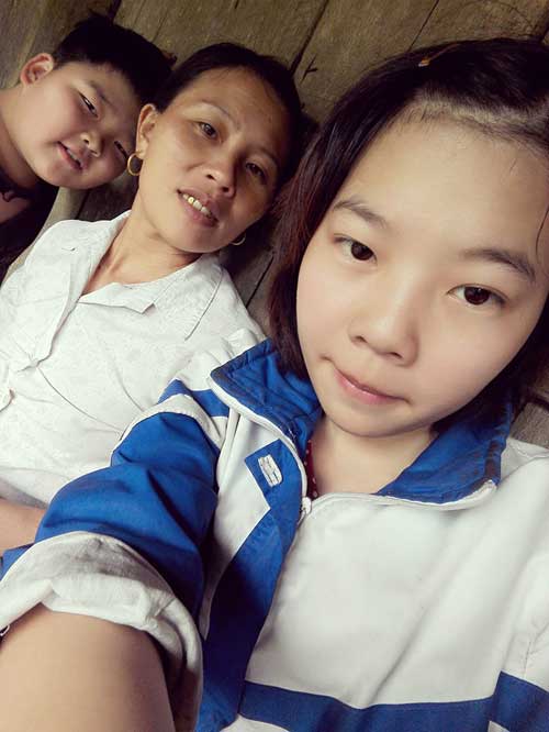 Nữ công nhân xinh đẹp bị máy dập nát đôi tay giờ ra sao? - 2