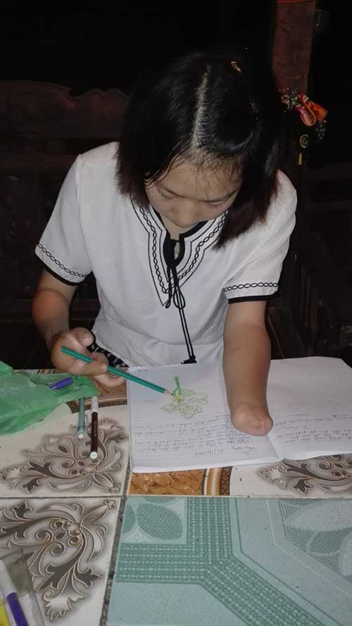 Nữ công nhân xinh đẹp bị máy dập nát đôi tay giờ ra sao? - 4