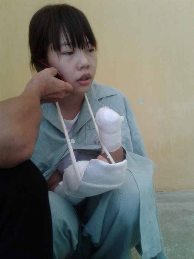 Nữ công nhân xinh đẹp bị máy dập nát đôi tay giờ ra sao? - 1