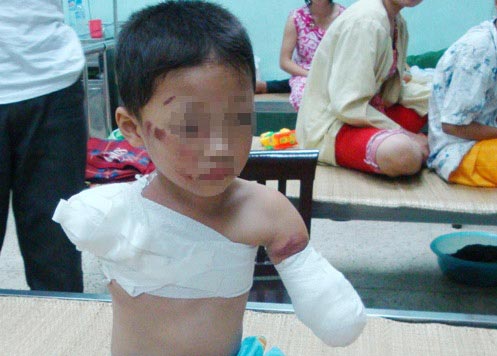 Câu chuyện thương tâm về tai nạn của trẻ khiến ai biết cũng ám ảnh - 3