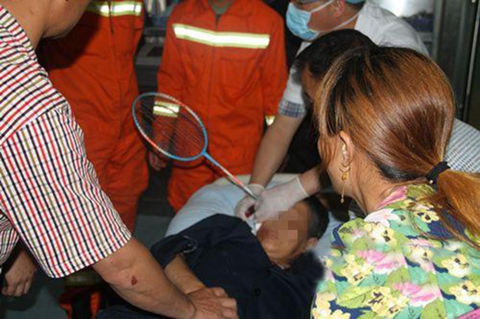 Xem cháu đánh cầu lông, bà bị vợt cắm vào đầu - 1