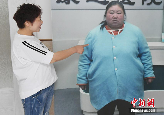 Bị chồng bỏ, cô nàng Trung Quốc giảm 121 kg và nhận &#34;quả ngọt&#34; - 1