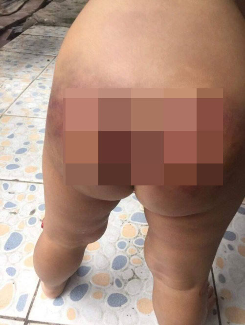 Bình Dương: Nghi án bé trai 2 tuổi bị bạn trai của mẹ bạo hành - 1