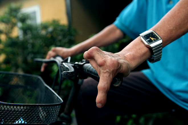 Kì lạ gia đình tay một ngón, chân như chân chim ở Hà Nam - 8