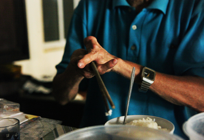 Kì lạ gia đình tay một ngón, chân như chân chim ở Hà Nam - 14