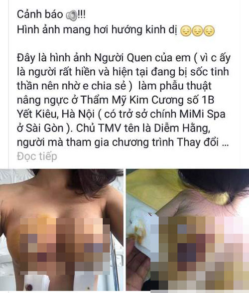 Thông tin mới vụ nhập viện sau khi nâng ngực ở Hà Nội - 2