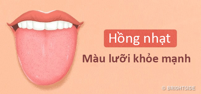 Màu lưỡi nói lên tình trạng sức khỏe của bạn thế nào? - 1