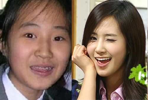 Các mỹ nhân không dám cười "thả phanh" và đây là lý do bất ngờ - 9