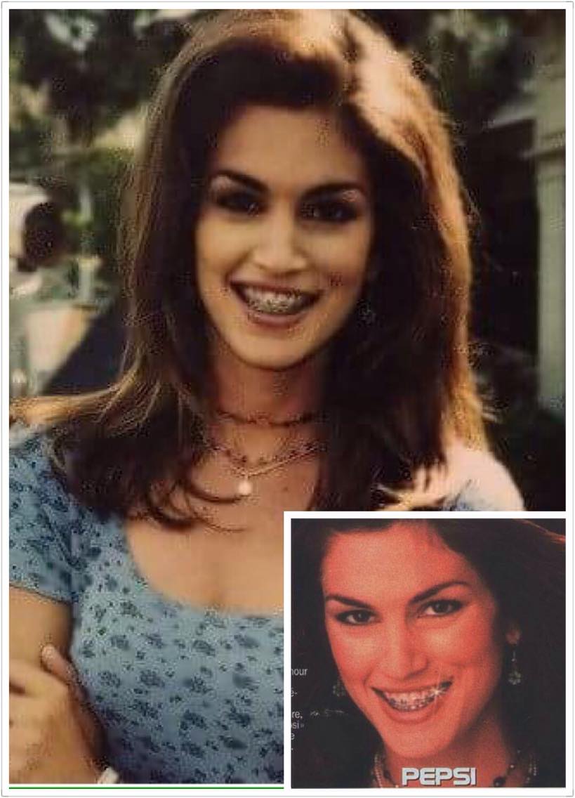 Các mỹ nhân không dám cười "thả phanh" và đây là lý do bất ngờ - 11