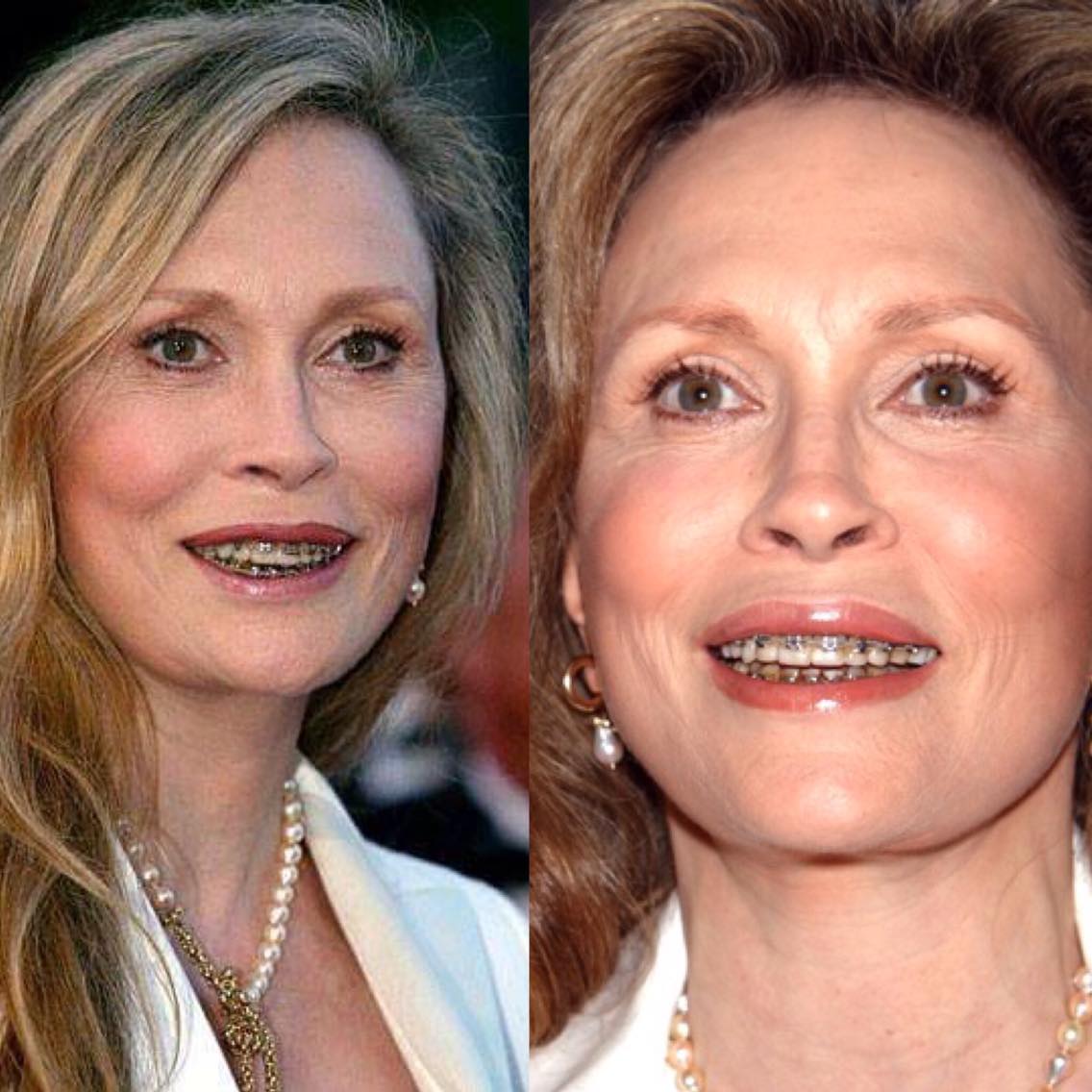 Các mỹ nhân không dám cười "thả phanh" và đây là lý do bất ngờ - 4