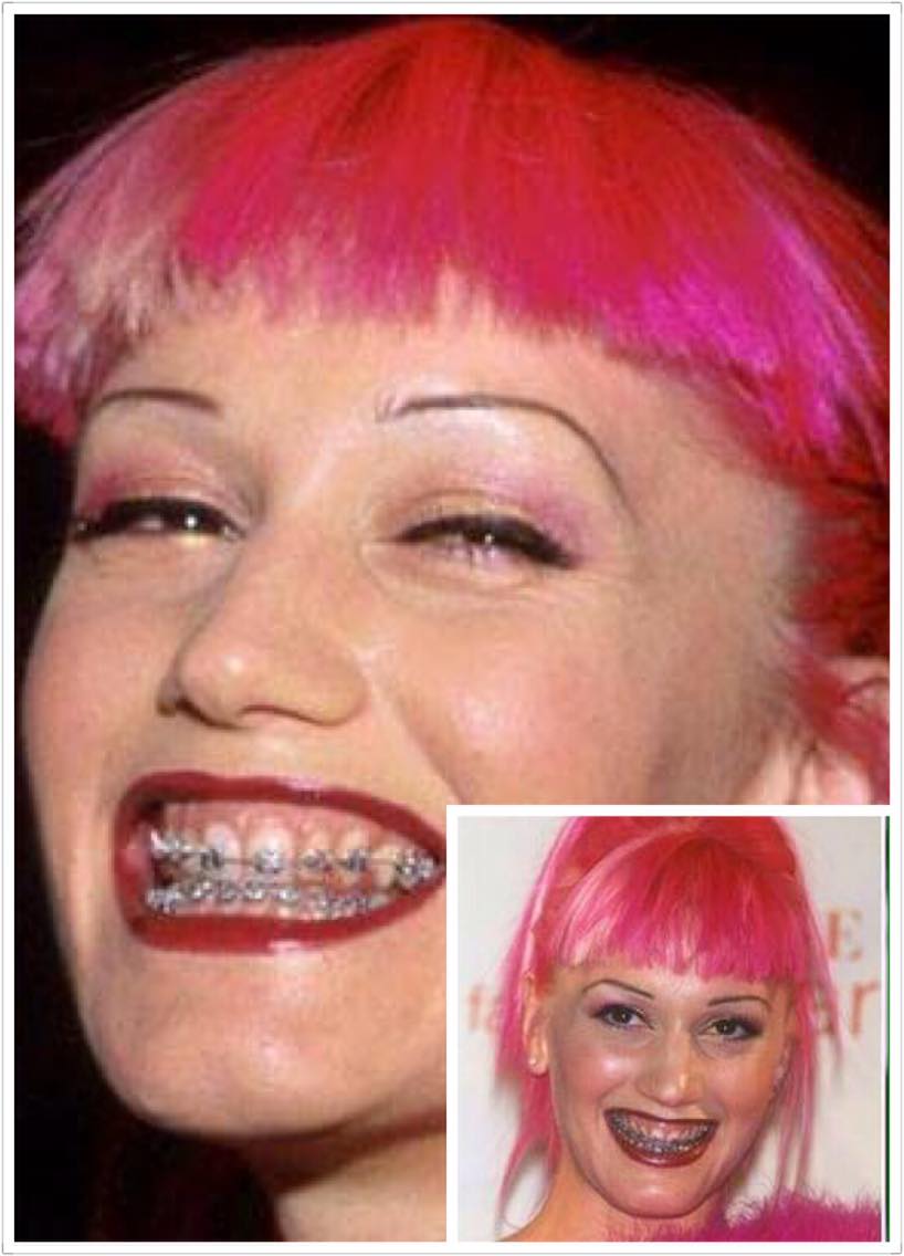 Các mỹ nhân không dám cười "thả phanh" và đây là lý do bất ngờ - 6