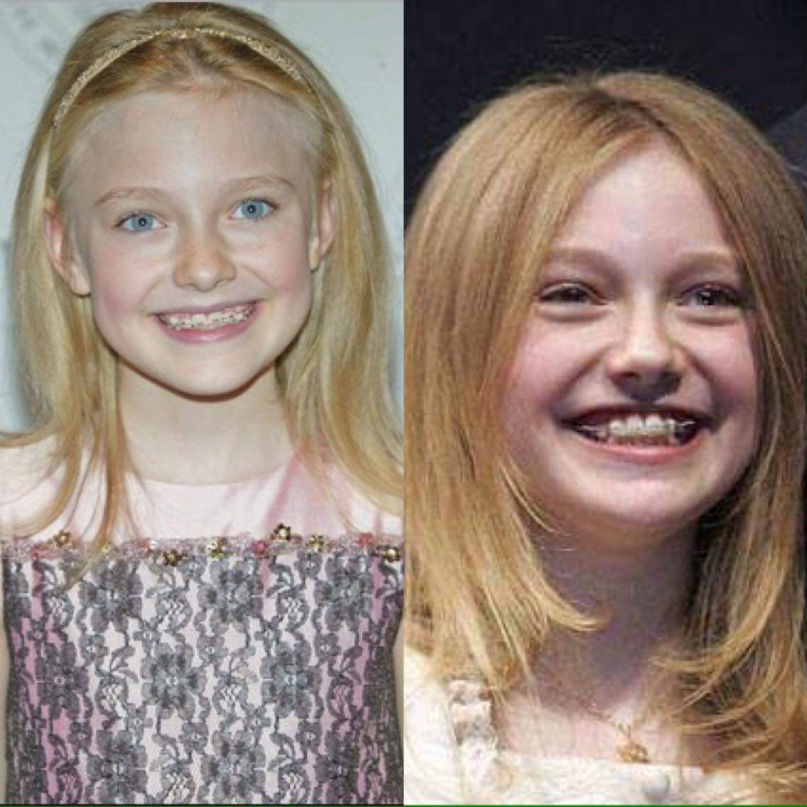 Các mỹ nhân không dám cười "thả phanh" và đây là lý do bất ngờ - 8